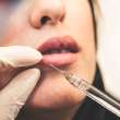 Best Place to Buy Botox Online