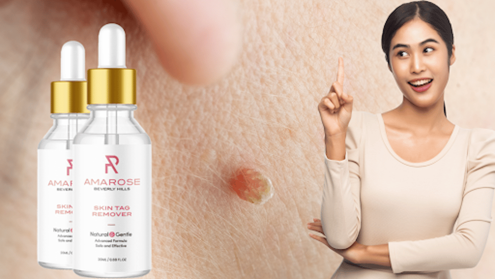 Amarose Mole Removal Reviews – Does It Really Work or Scam?