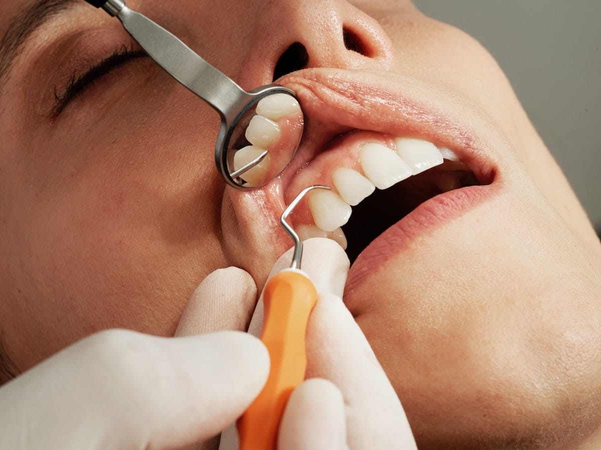 Five Most Common Dental Procedures
