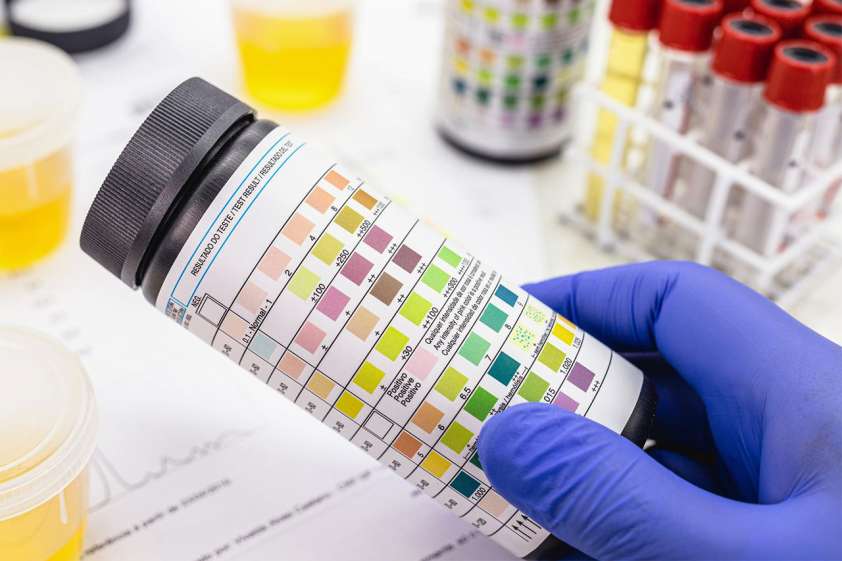Best Fake Pee For Drug Tests What's the Best Synthetic Urine Kit for Drug Tests? - UrbanMatter