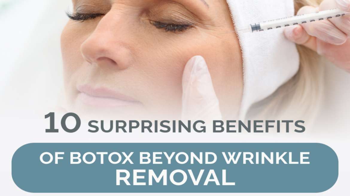 Benefits of Botox