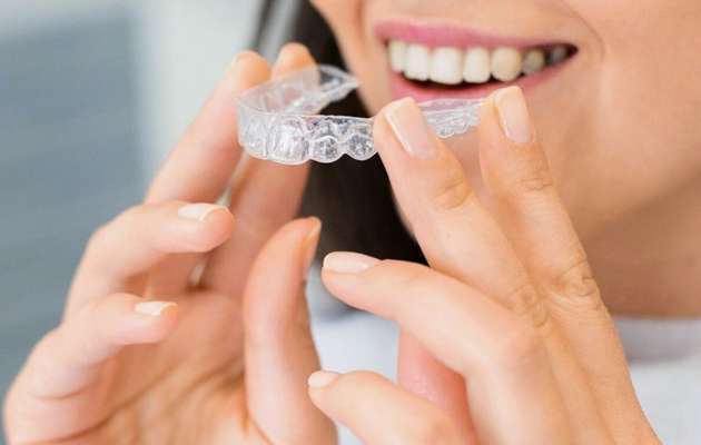 Invisalign