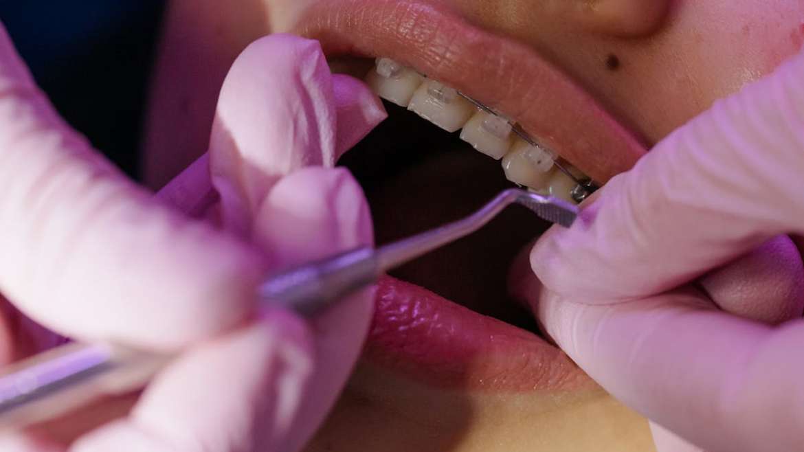 Orthodontic treatment