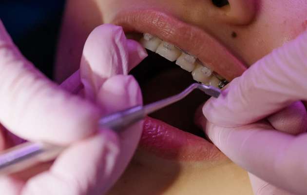Orthodontic treatment