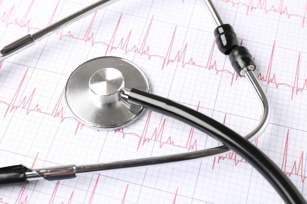 Heart Beat report